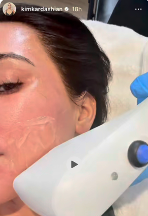 Sofwave: Kim Kardashian’s Secret to Youthful, Toned Skin