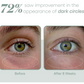 Exosome Eye Serum